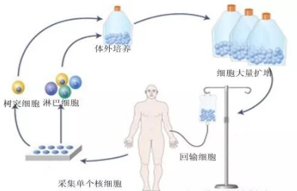 DC-CIK生物免疫疗法治疗肿瘤的优势作用详解